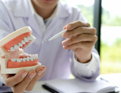 Enfermedades bucodentales más comunes: caries, gingivitis y periodontitis.